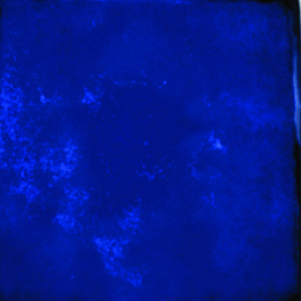 Blaze 25x75 -  Blue I 12.5x12.5